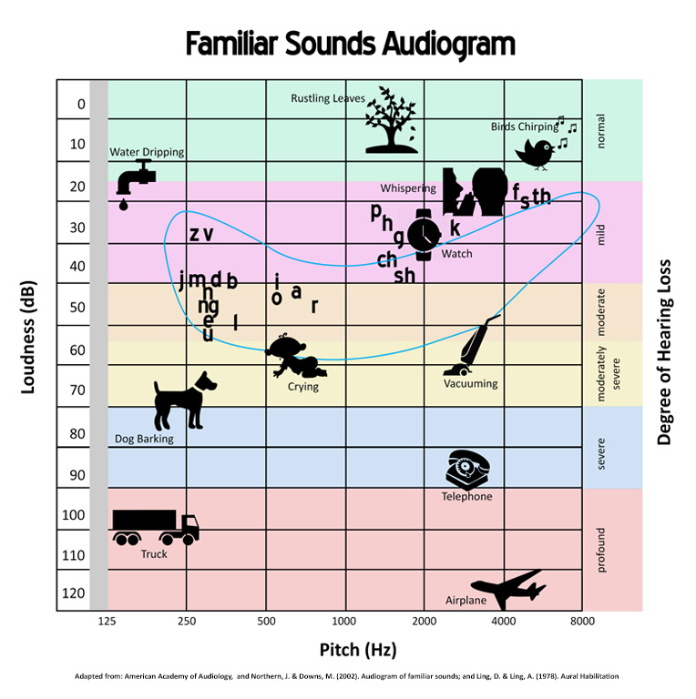 Audiology Waukesha WI Audiogram Audiology Waukesha WI Audiogram